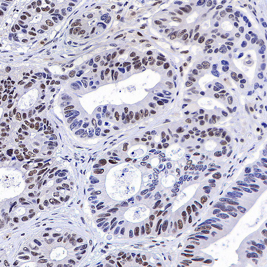 YY1 Recombinant Rabbit mAb (S-3652-44)