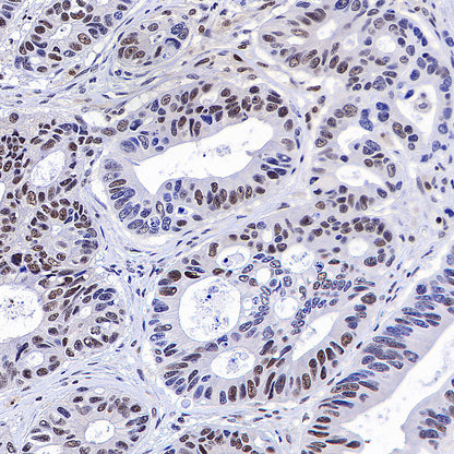 YY1 Recombinant Rabbit mAb (S-3652-44)
