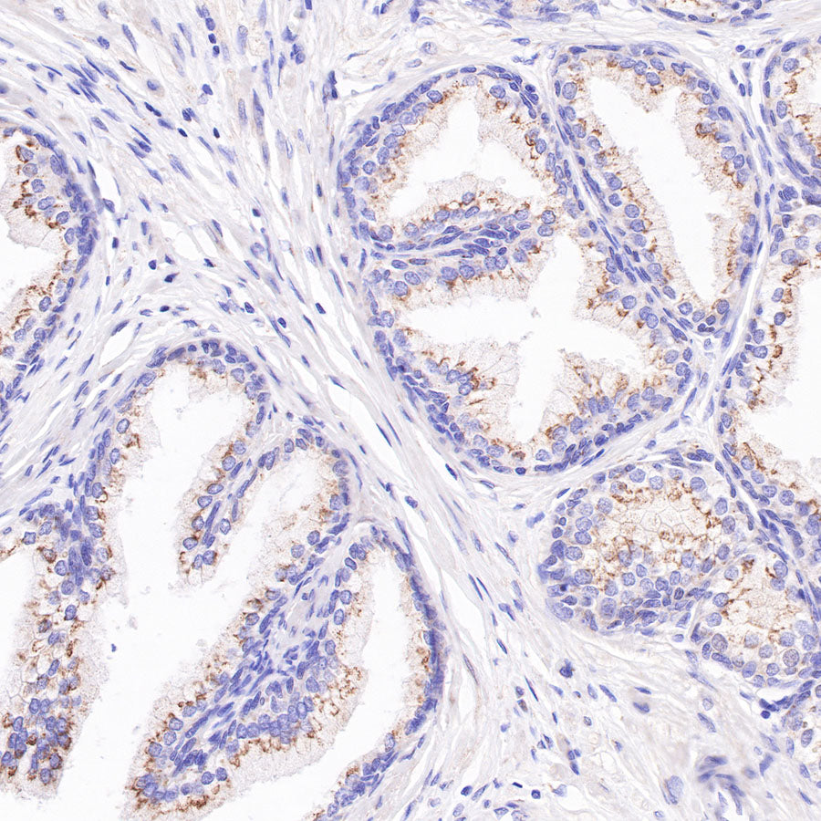 AMACR/p504s Recombinant Rabbit mAb (SDT-401-29)