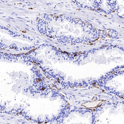 HLA-DP alpha1 Recombinant Rabbit mAb (S-R243)