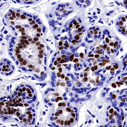 ER alpha Recombinant Rabbit mAb (SDT-2950-36)