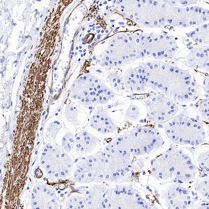 TAGLN/Transgelin Recombinant Rabbit mAb (S-1715-59)
