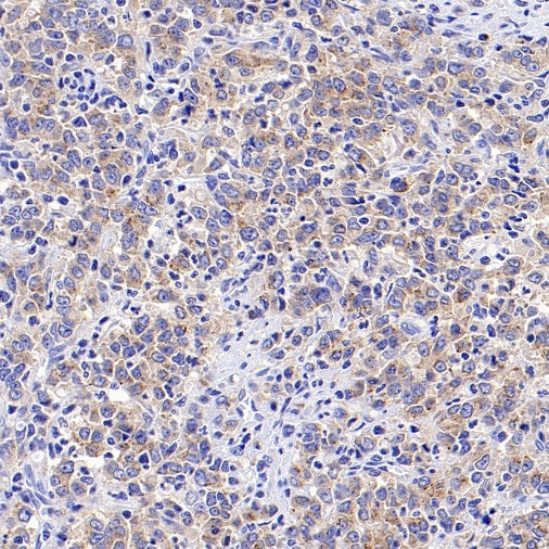 SEC23B Recombinant Rabbit mAb (S-1935-28)