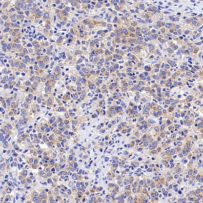 SEC23B Recombinant Rabbit mAb (S-1935-28)