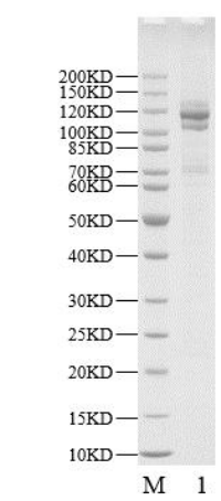GIPR [I307C, G351C] Flag&His Tag Protein, Human