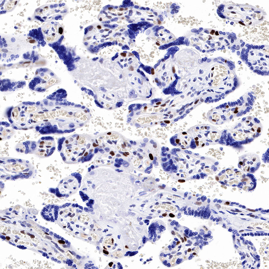 Cyclin D3 Recombinant Rabbit mAb (SDT-R124)