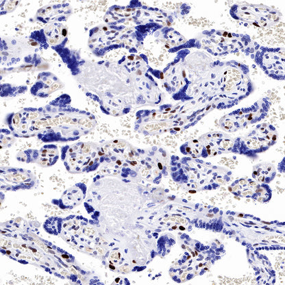 Cyclin D3 Recombinant Rabbit mAb (SDT-R124)