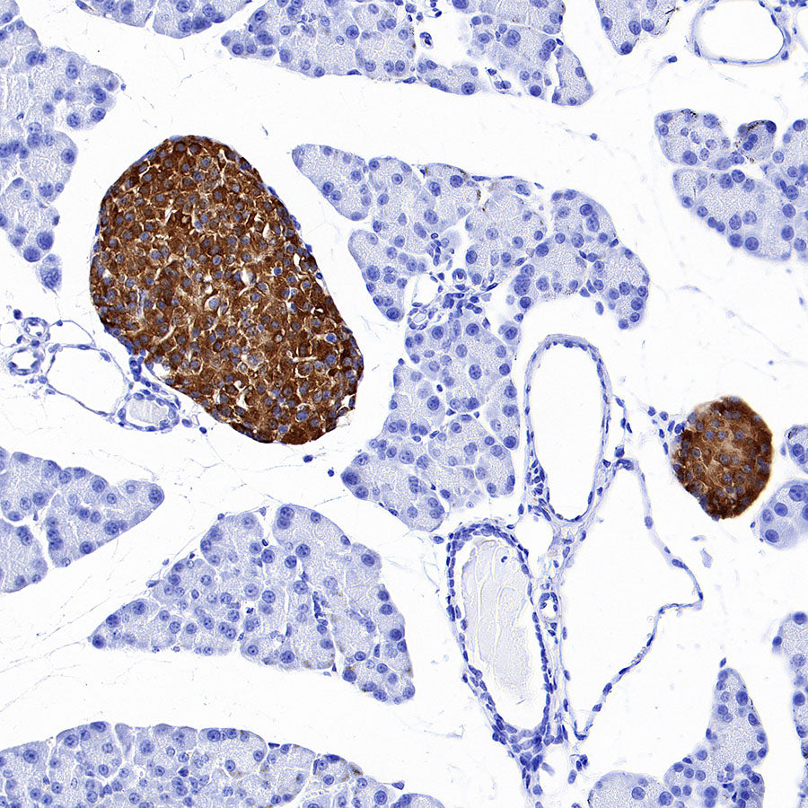 SV2A Recombinant Rabbit mAb (S-4049-16)