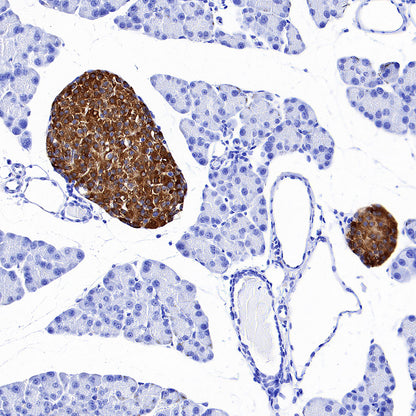 SV2A Recombinant Rabbit mAb (S-4049-16)