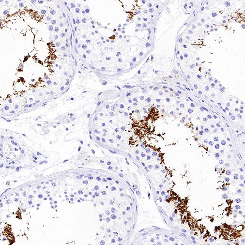 AKAP4 Recombinant Rabbit mAb (SDT-4196)