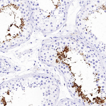AKAP4 Recombinant Rabbit mAb (SDT-4196)