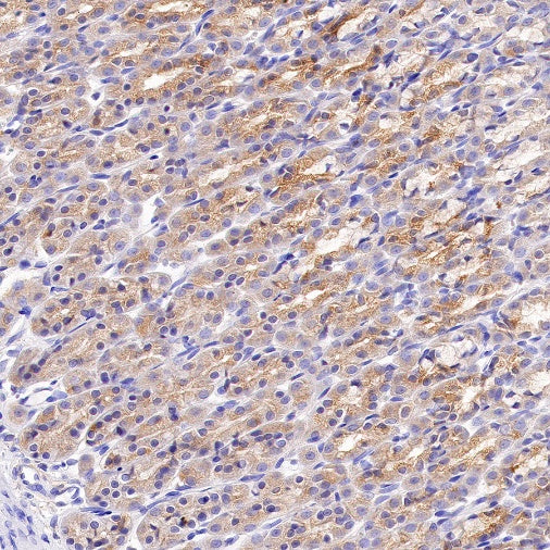 Tuberin/TSC2 Recombinant Rabbit mAb (S-1138-125)