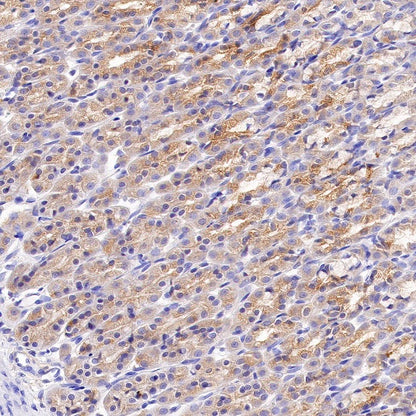 Tuberin/TSC2 Recombinant Rabbit mAb (S-1138-125)