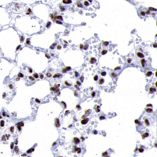 PPARγ Recombinant Rabbit mAb (SDT-556-108)