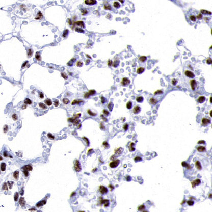 PPARγ Recombinant Rabbit mAb (SDT-556-108)