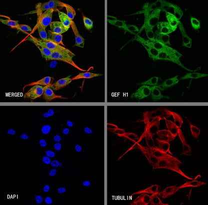 GEF H1 Recombinant Rabbit mAb (S-6057)