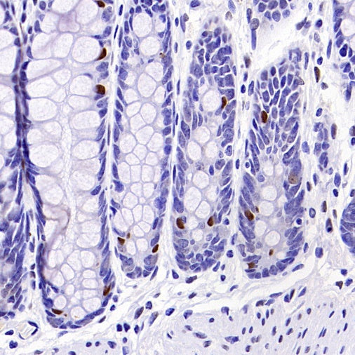 Islet1 Recombinant Rabbit mAb (SDT-2349-17)