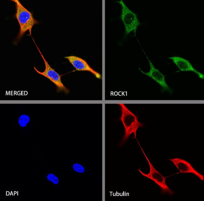 ROCK1 Recombinant Rabbit mAb (S-1304-153)