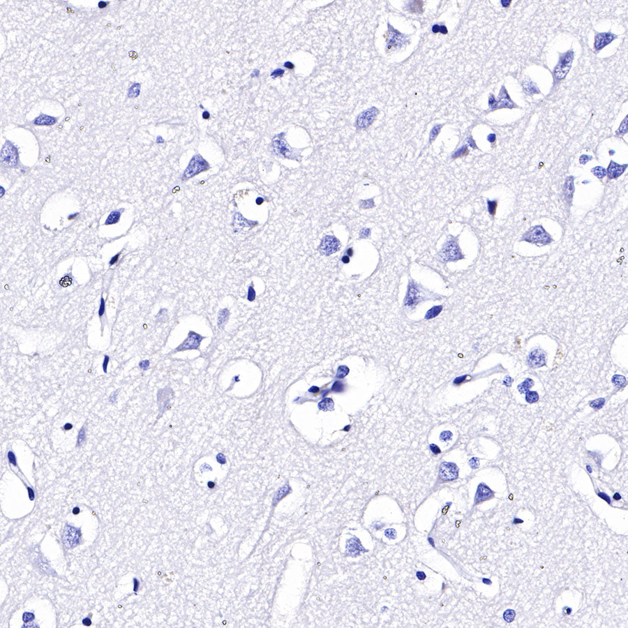 CD4 Recombinant Rabbit mAb,PBS Only (SDT-R163)