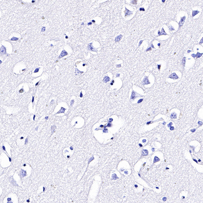 CD4 Recombinant Rabbit mAb,PBS Only (SDT-R163)