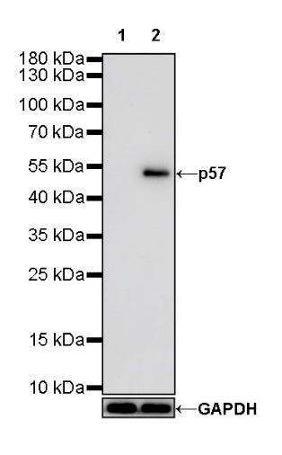 p57 Recombinant Rabbit mAb (SDT-191-79)