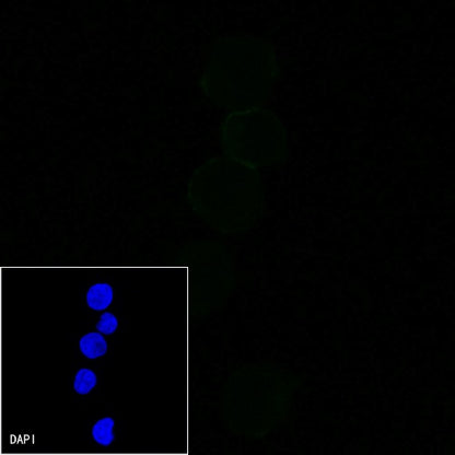 CD20 Recombinant Rabbit mAb (Alexa Fluor® 488 Conjugate) (S-R133)