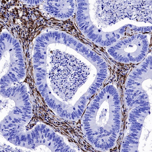 Galectin-1 Recombinant Rabbit mAb (S-1221-32）