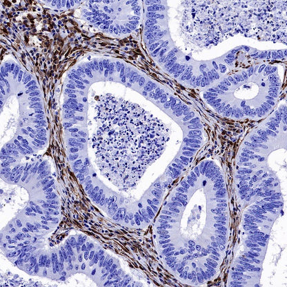 Galectin-1 Recombinant Rabbit mAb (S-1221-32）