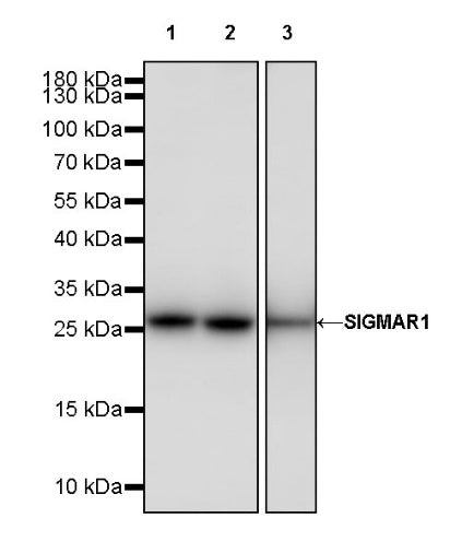 SIGMAR1 Recombinant Rabbit mAb (S-2079-270)