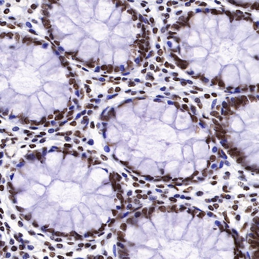 Histone H3 (mono methyl K36) Recombinant Rabbit mAb (S-R211)