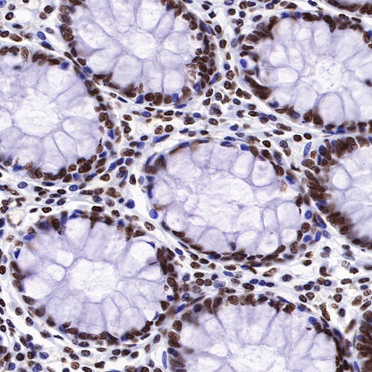 Histone H3 (mono methyl K36) Recombinant Rabbit mAb (S-R211)