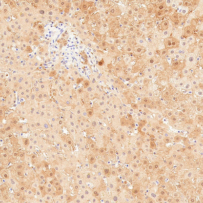 AK1C3 Rabbit Polyclonal Antibody