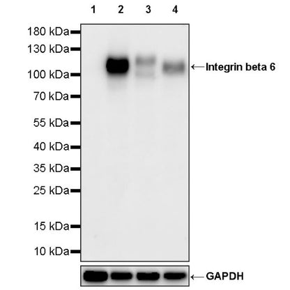 Integrin beta 6 Recombinant Rabbit mAb (SDT-1445-78)