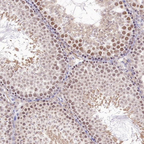 PSME4 Recombinant Rabbit mAb (S-3132-44)