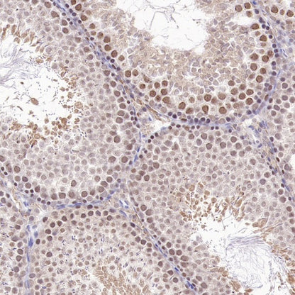 PSME4 Recombinant Rabbit mAb (S-3132-44)