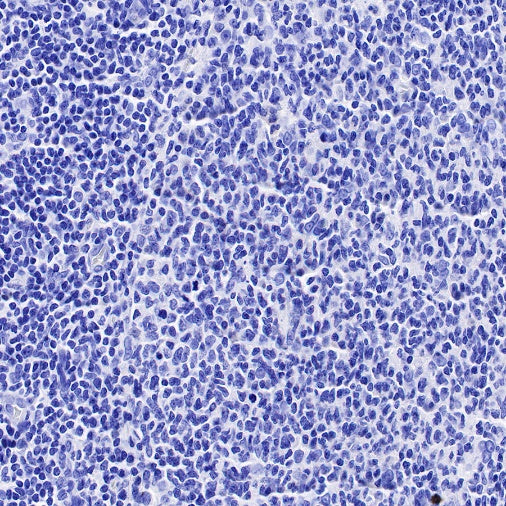 Human folate receptor alpha Recombinant Rabbit mAb (SDT-719-20-2)