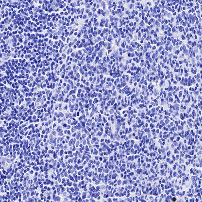 Human folate receptor alpha Recombinant Rabbit mAb (SDT-719-20-2)
