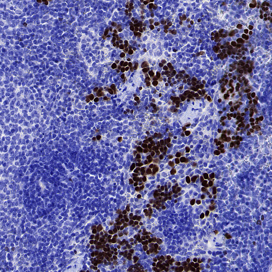 GATA1 Recombinant Rabbit mAb (S-5401)