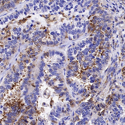 MX1 Rabbit Polyclonal Antibody