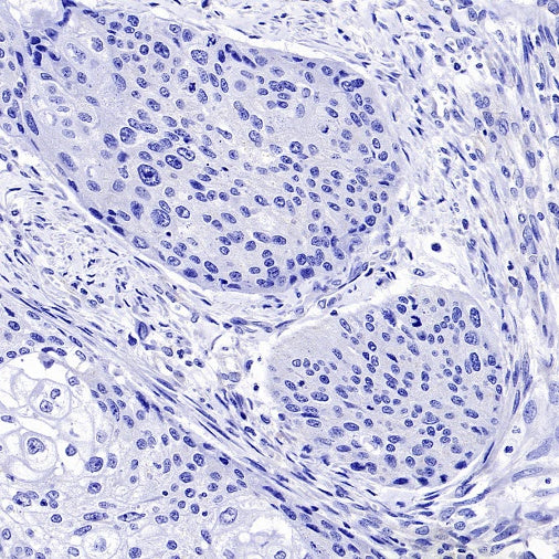 OTP Recombinant Rabbit mAb (SDT-2002-175)
