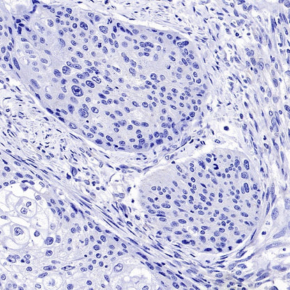 OTP Recombinant Rabbit mAb (SDT-2002-175)