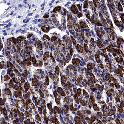 SOD2/MnSOD Rabbit Polyclonal Antibody