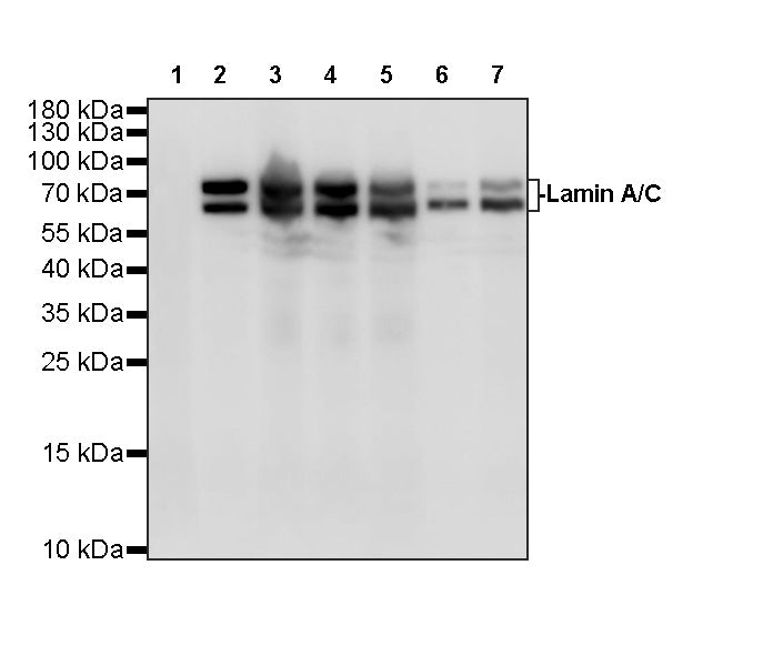 Lamin A/C Recombinant Rabbit mAb (S-5671)