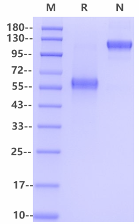 TNFR-1/CD120a Protein, Human