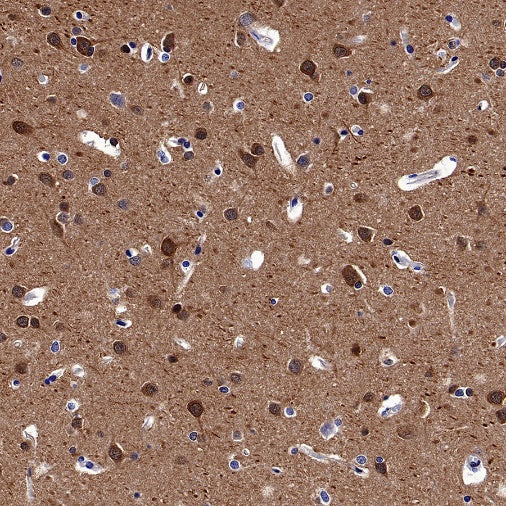 GSK3β Recombinant Rabbit mAb (S-1209-170)