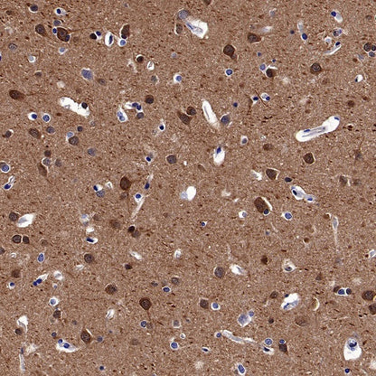 GSK3β Recombinant Rabbit mAb (S-1209-170)
