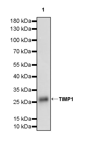 TIMP1 Recombinant Rabbit mAb (S-5147)