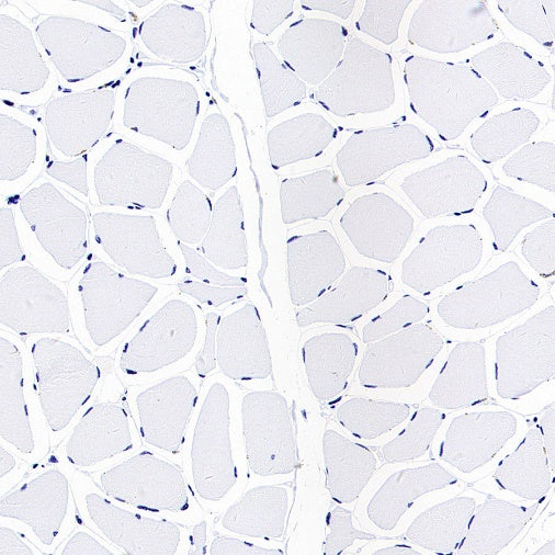 NaPi2b/SLC34A2 Recombinant Rabbit mAb, PBS Only (SDT-1771-79)