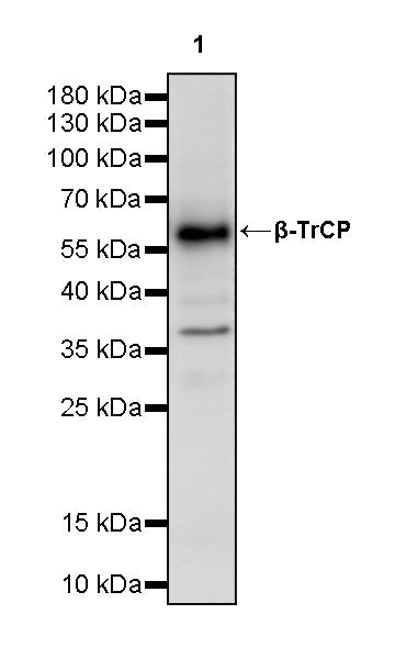 β-TrCP Recombinant Rabbit mAb (S-3941-63)