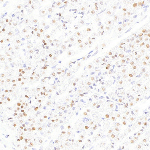 FOXP4 Recombinant Rabbit mAb (S-6198)